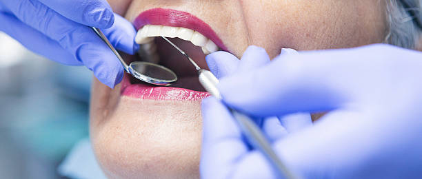 Best Emergency Dental Care for Sports Injuries in Broxton, GA